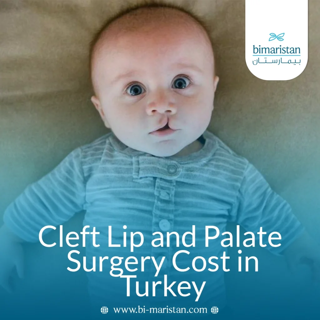 Cleft Lip And Palate Surgery Cost In Turkey 2026: Affordable Treatment, Expert Care, And Rehabilitation Options 3 Cleft Lip And Palate Surgery Cost In Turkey