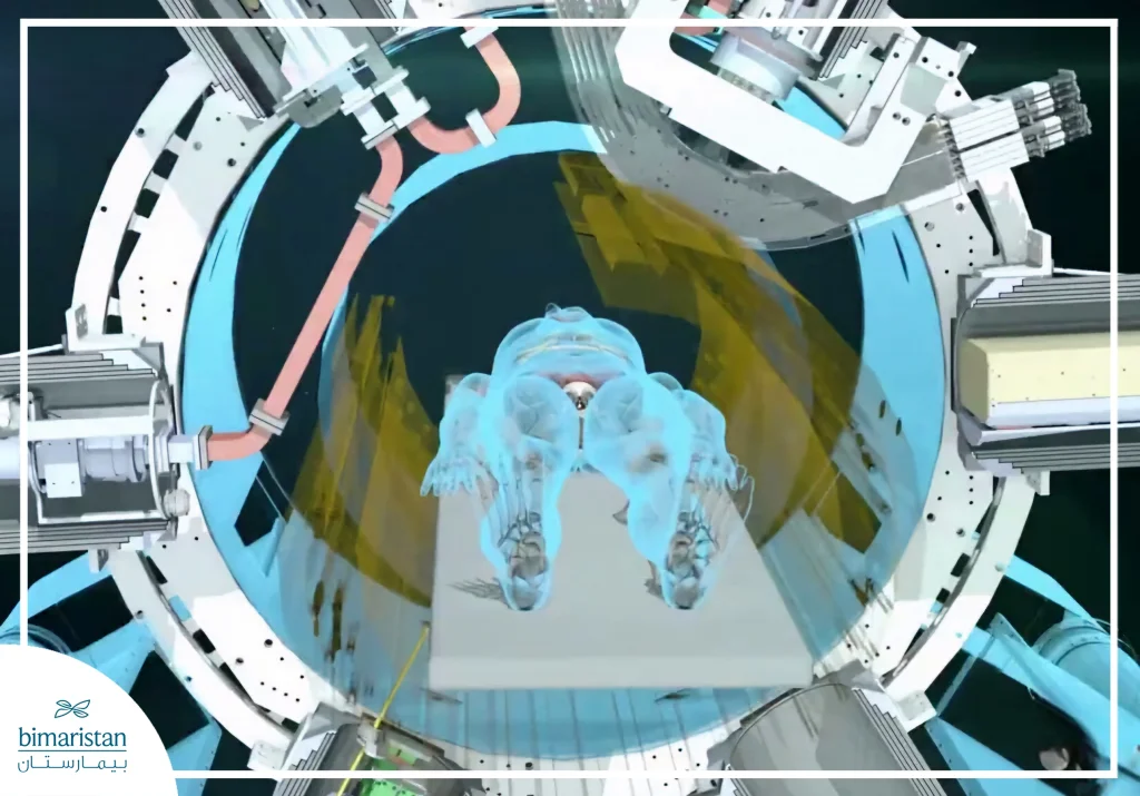 Mri‑Linac Cost In Turkey 2026: Treatment Prices, Packages &Amp; Top Centers 3 Illustration Showing A Patient Positioned Inside The Mr-Linac Radiotherapy System.