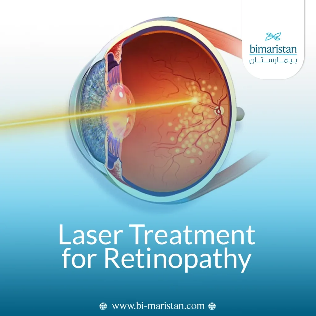 Laser Treatment For Retinopathy