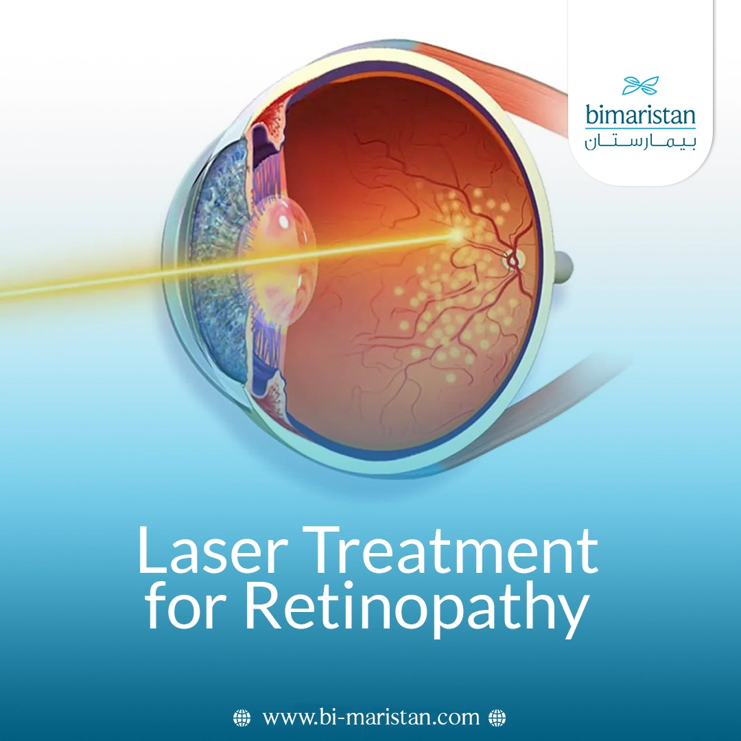 Laser Treatment For Retinopathy