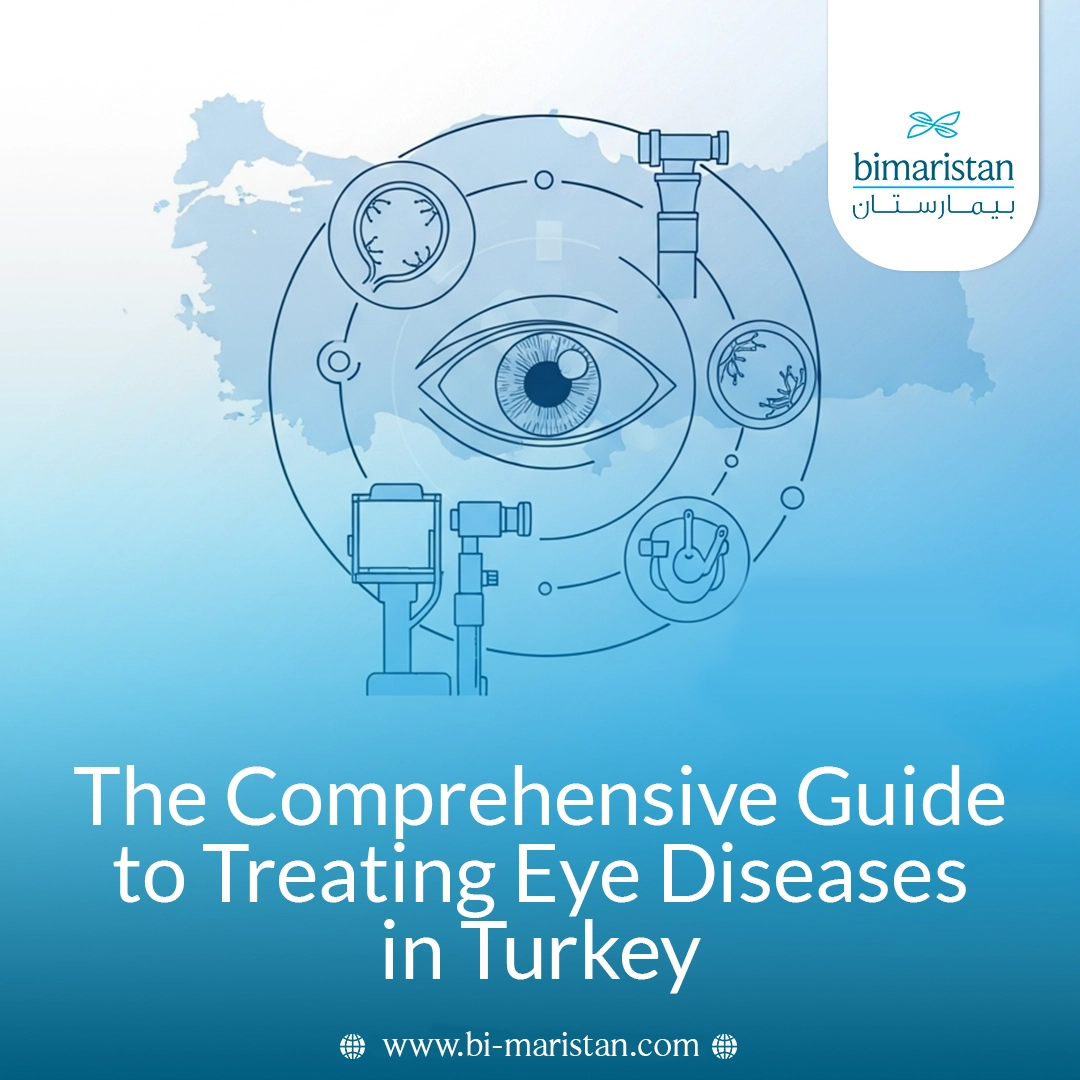 A Comprehensive Guide To Treating Eye Diseases In Turkey 15 A Comprehensive Guide To Treating Eye Diseases In Turkey
