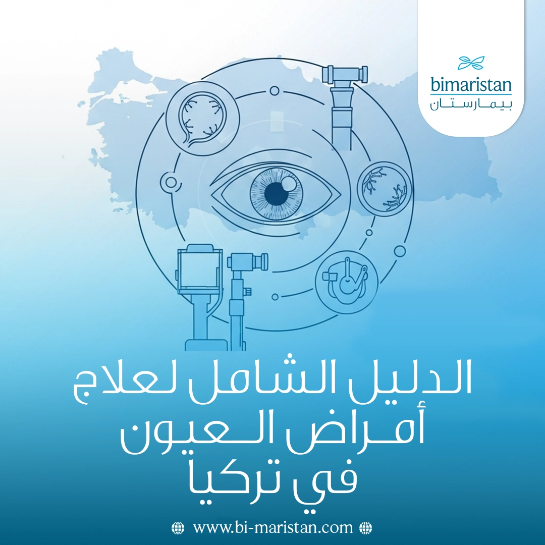 الدليل الشامل لعلاج أمراض العيون في تركيا