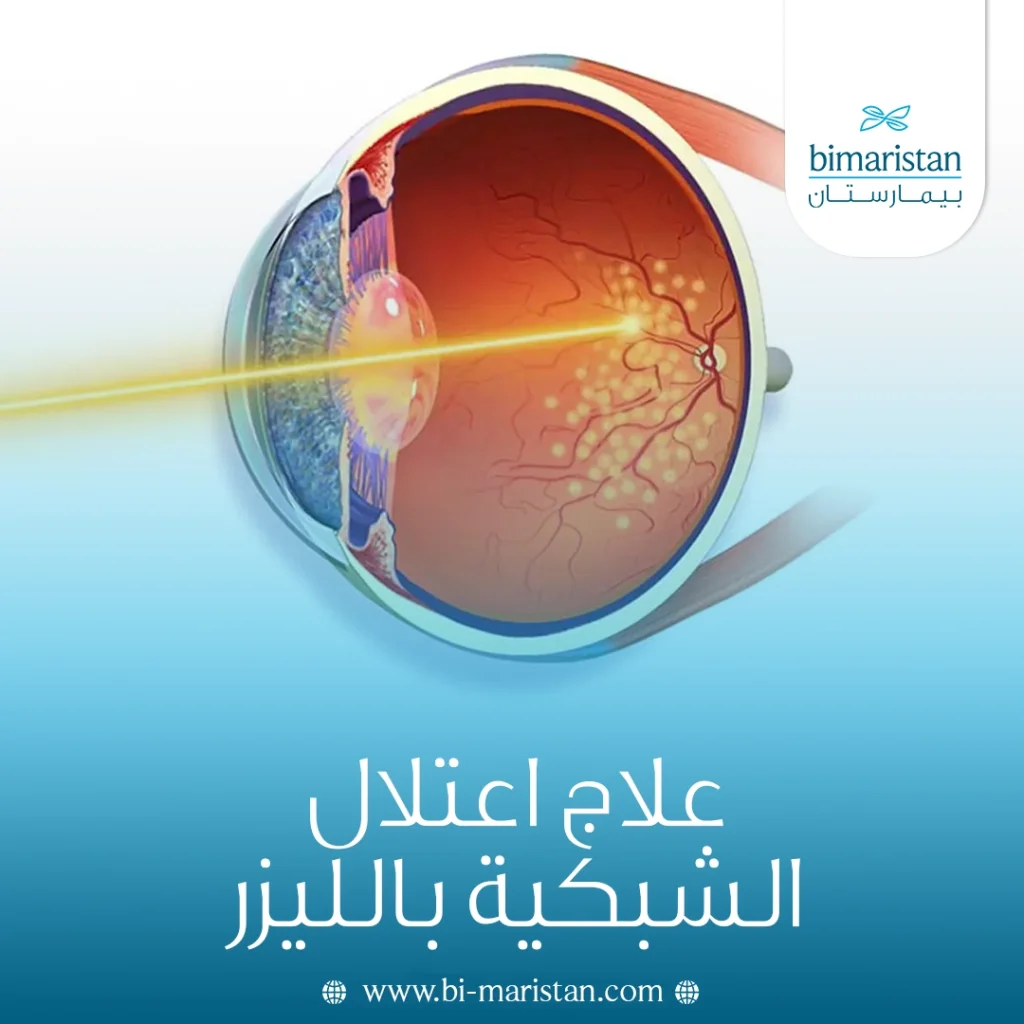علاج اعتلال الشبكية بالليزر