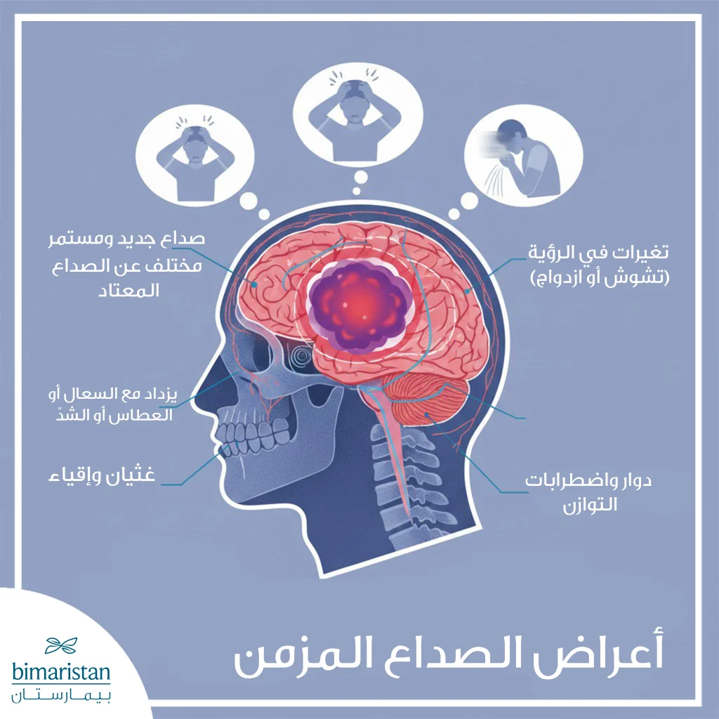 أعراض الصداع المزمن