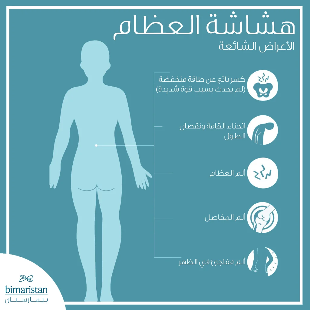 علاج هشاشة العظام بالخلايا الجذعية: الفوائد وطرق العلاج 14 أهم أعراض هشاشة العظام