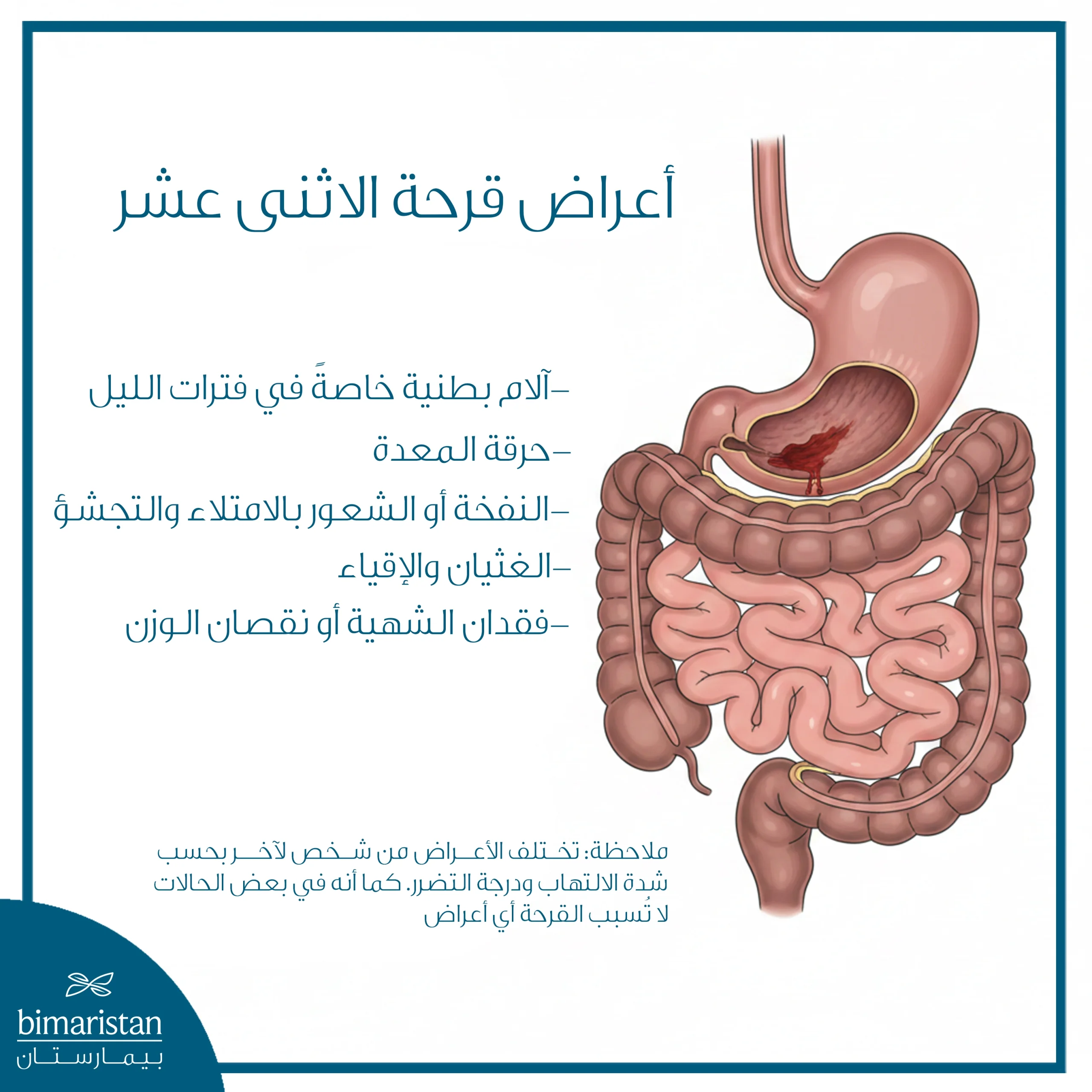توضح الصورة أهم أعراض قرحة الاثنى عشر