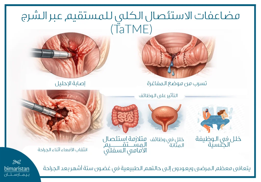 توضح الصورة مضاعفات الاستئصال الكلي للمستقيم عبر الشرج
