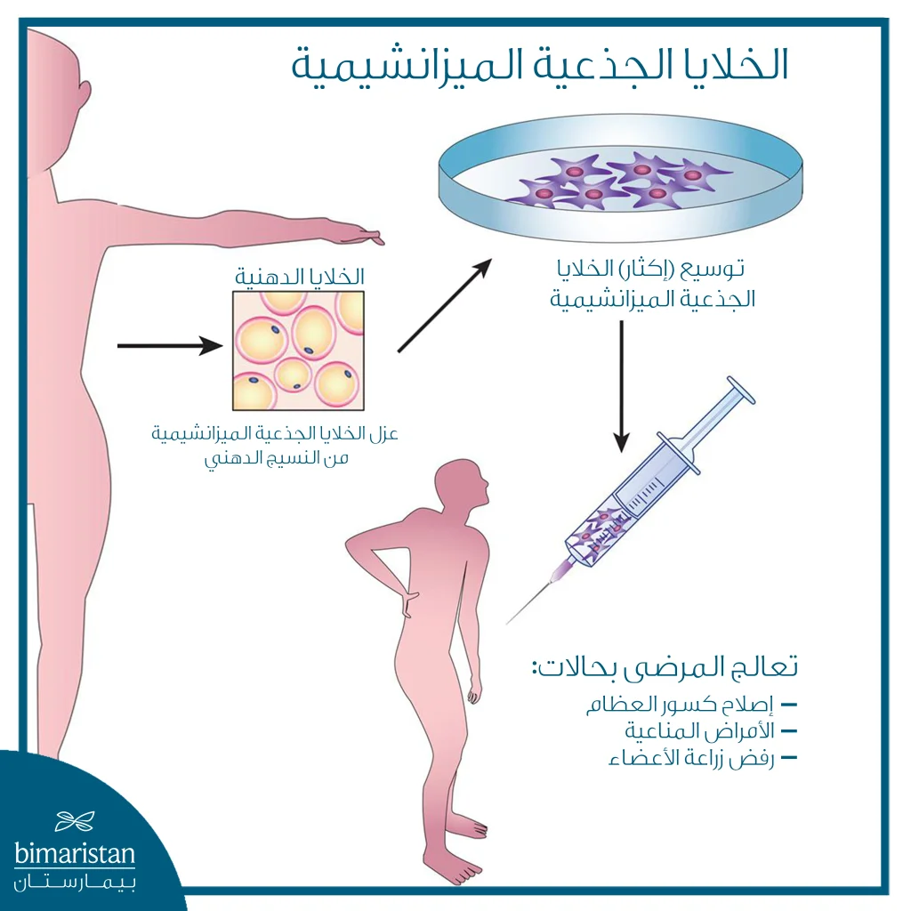 أنواع حقن التهاب المفاصل واستخداماتها 15 حقن الخلايا الجذعية الاستخدامات والمؤشرات