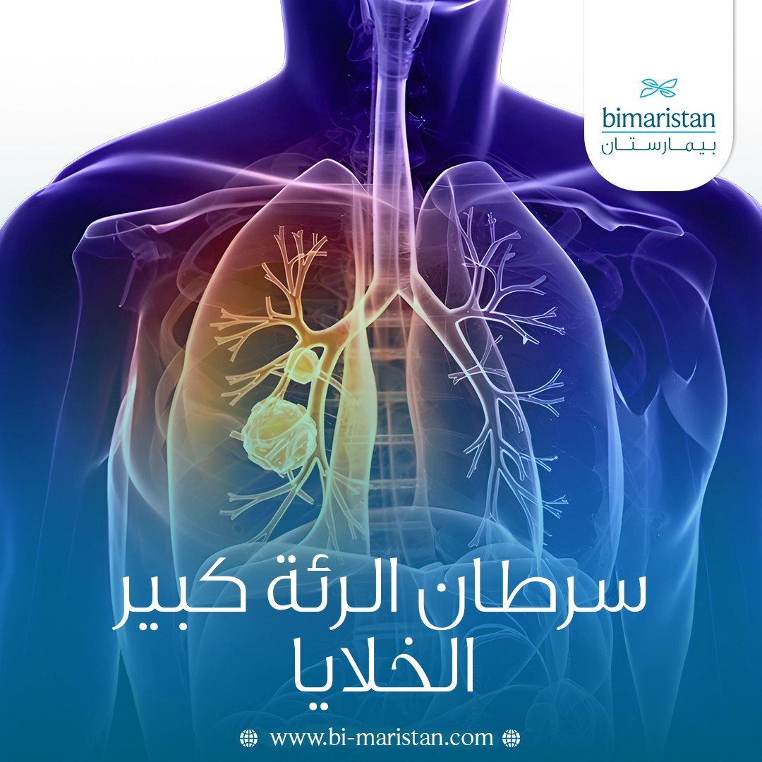 سرطان الرئة كبير الخلايا