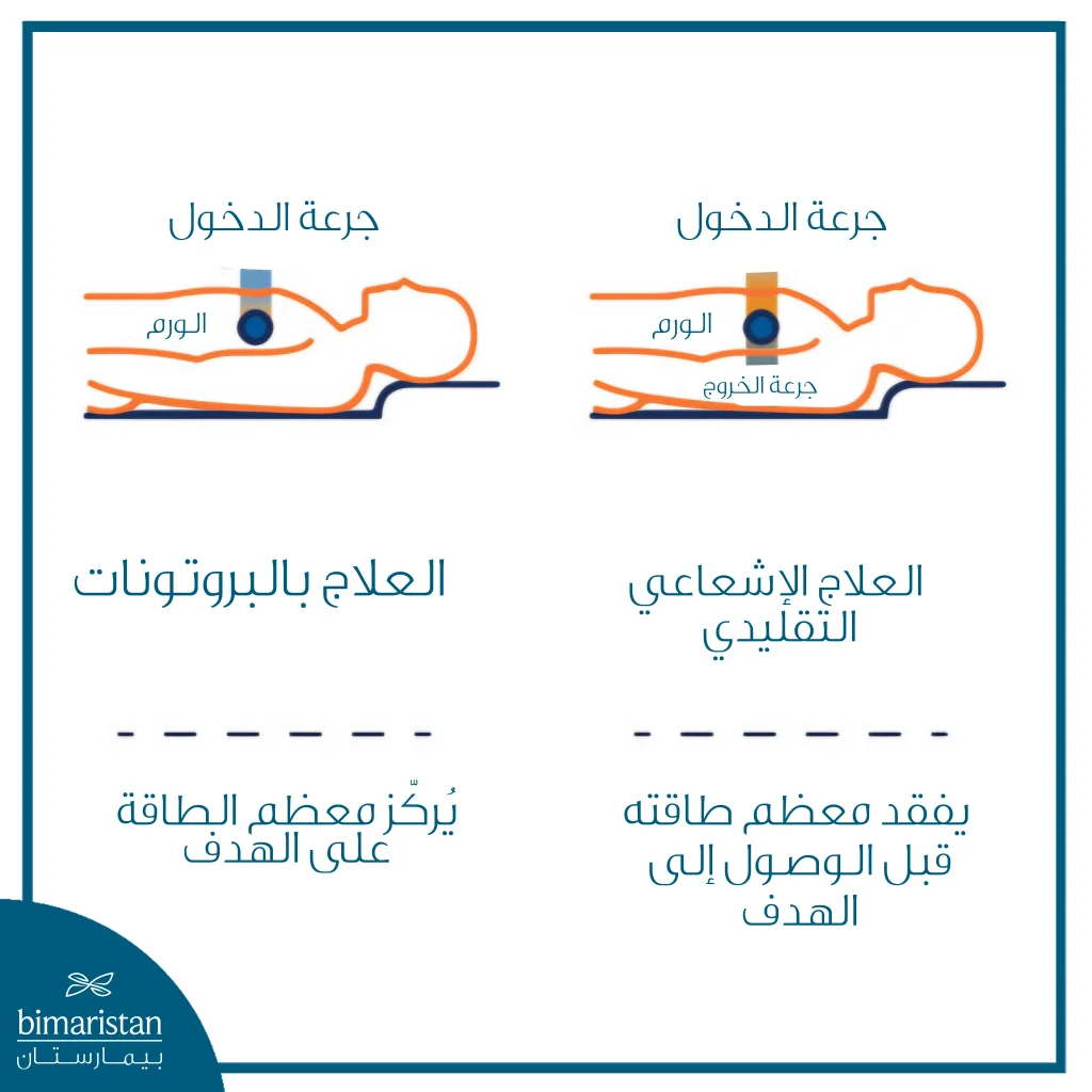 العلاج بالبروتونات لسرطان الرئة: متى يُستخدم وما الذي يميّزه؟ 4 صورة توضيحية تُظهر الفرق بين العلاج بالبروتونات والعلاج الإشعاعي التقليدي في توزيع جرعة الإشعاع على الورم والأنسجة المحيطة