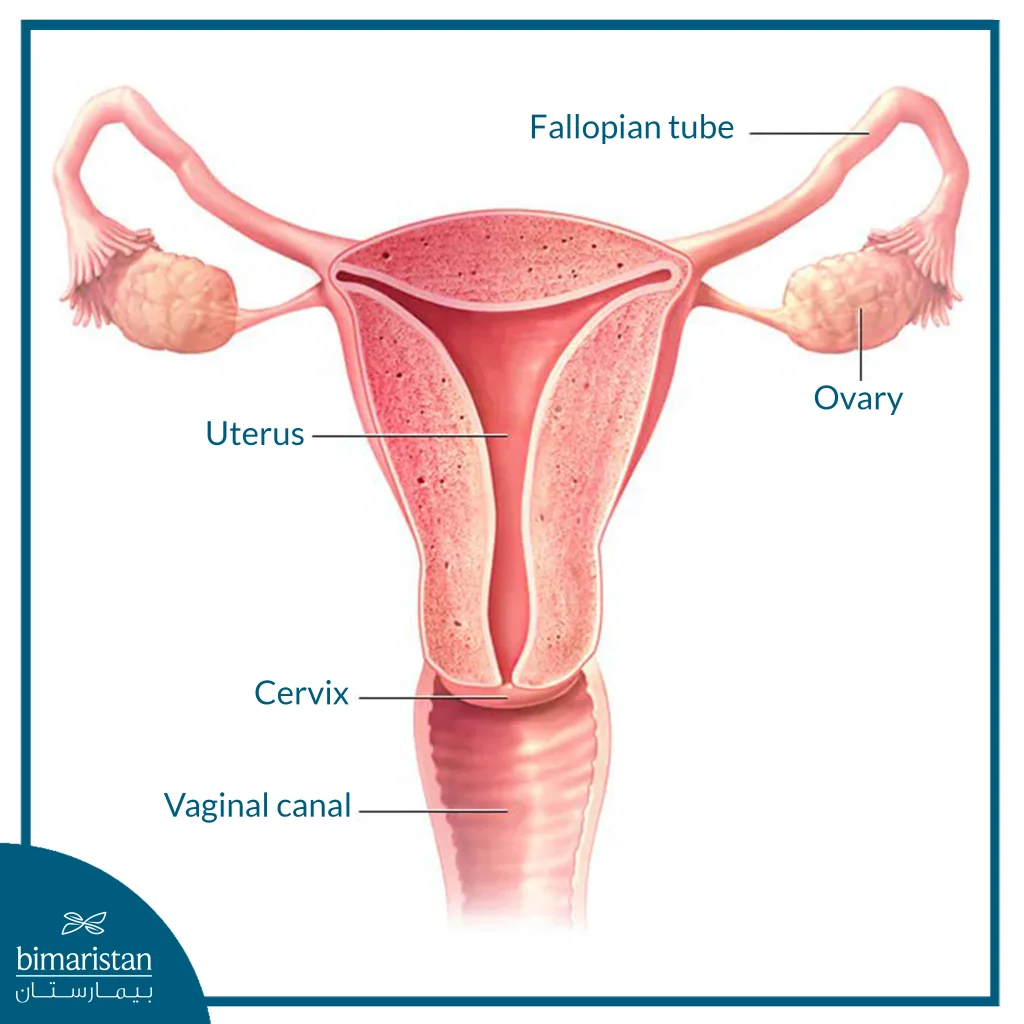 A Medical Illustration Showing The Normal Anatomy Of The Female Reproductive System, Including The Uterus, Ovaries, Fallopian Tubes, Cervix, And Vaginal Canal.