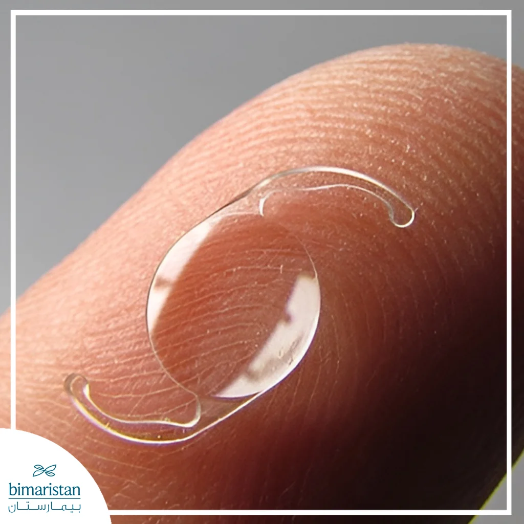Artificial Intraocular Lens Displayed On A Fingertip Used In Intraocular Lens Implantation Surgery
