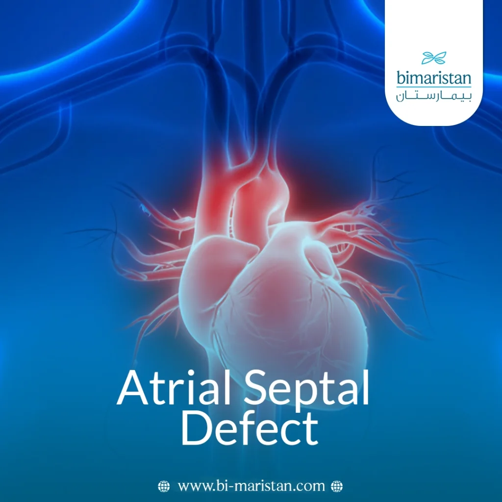 Atrial Septal Defect
