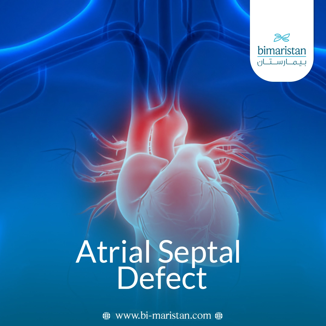 Atrial Septal Defect