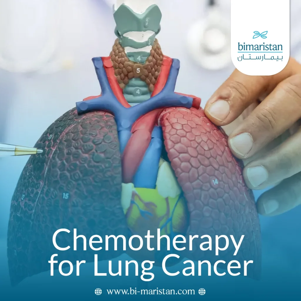 Chemotherapy For Lung Cancer: Use, Side Effects, And Follow‑Up Care Explained 5 Chemotherapy For Lung Cancer