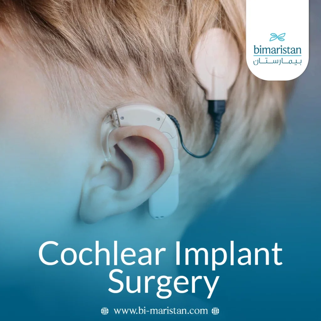 Cochlear Implant Surgery