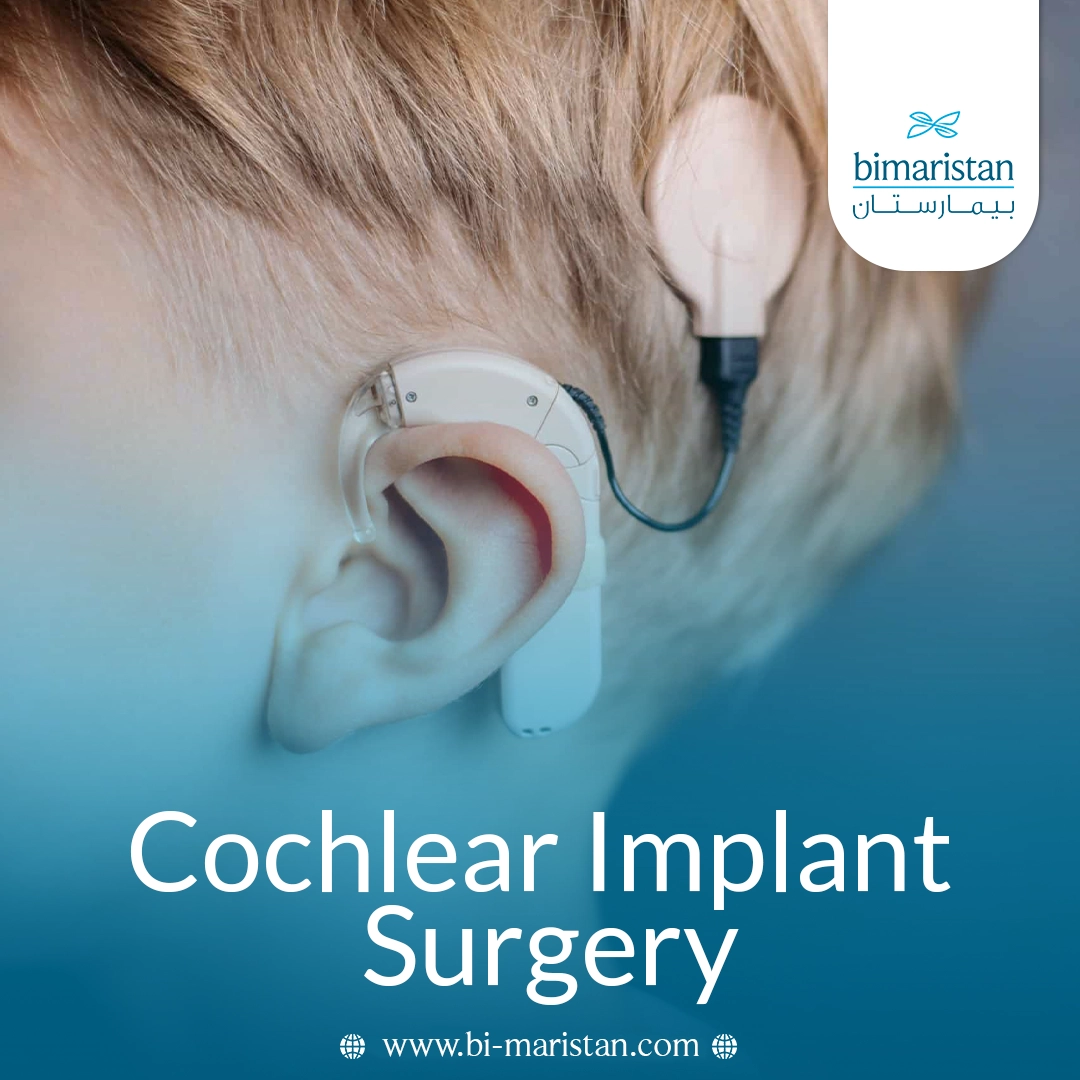 Cochlear Implant Surgery