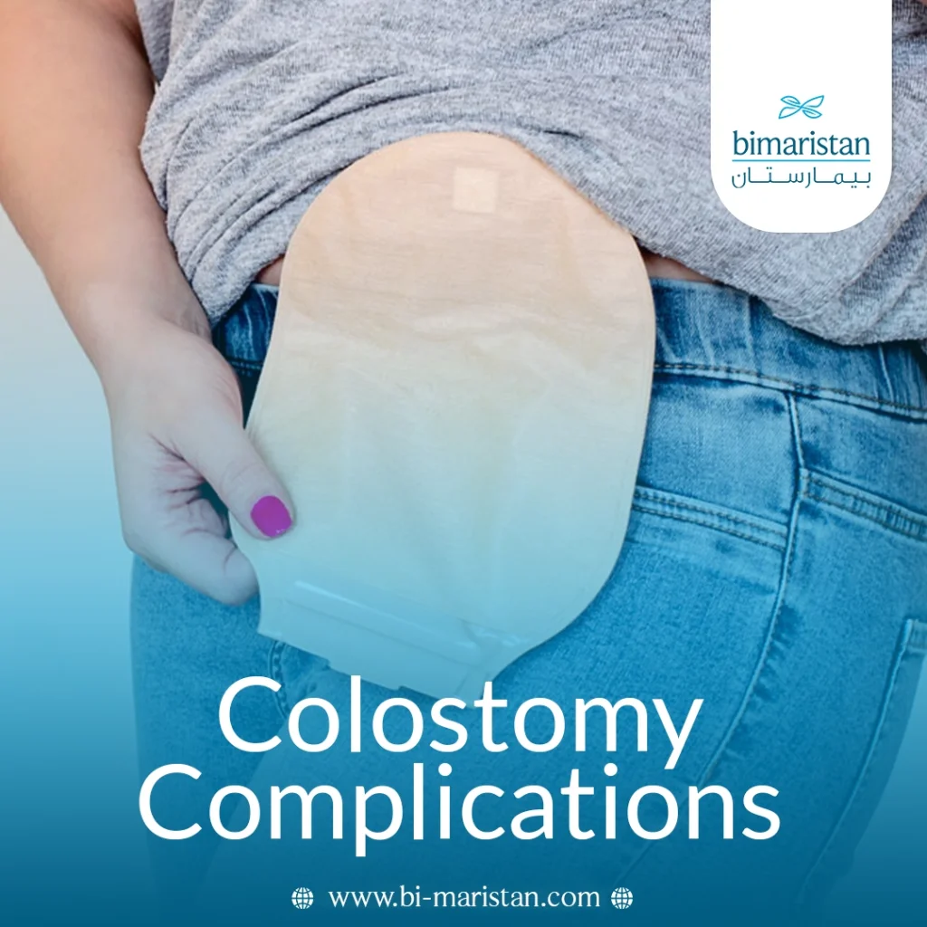 Colostomy Complications