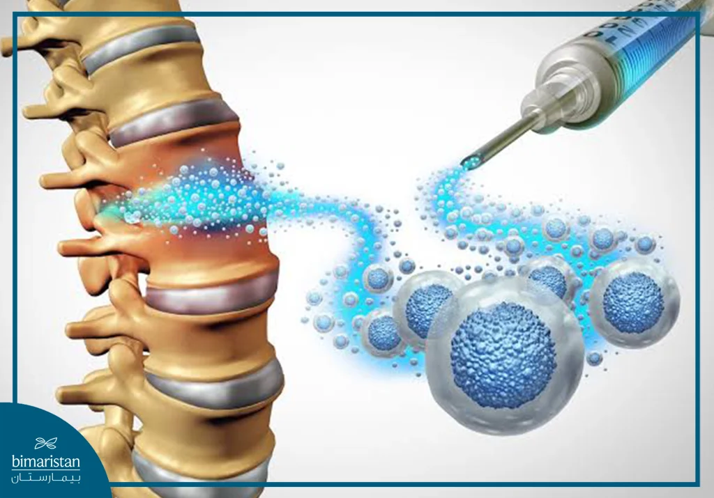 Has Stem Cell Therapy Become The Best Solution