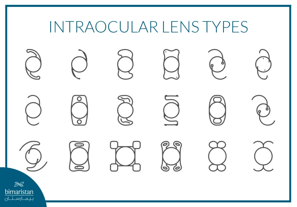 Illustration Showing Different Designs And Shapes Of Intraocular Lenses Used In Lens Implantation Surgeries