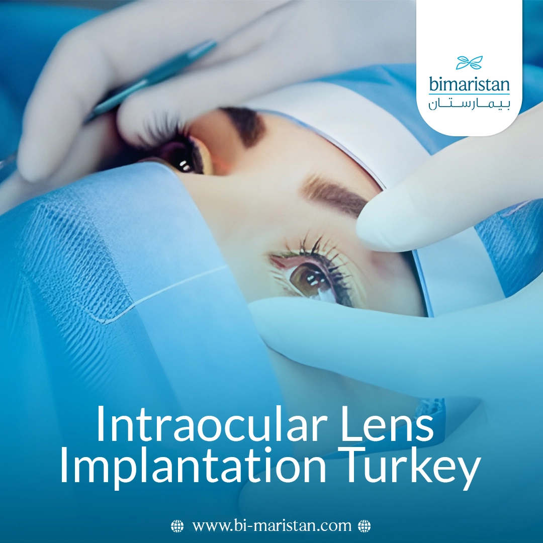 Intraocular Lens Implantation In Turkey