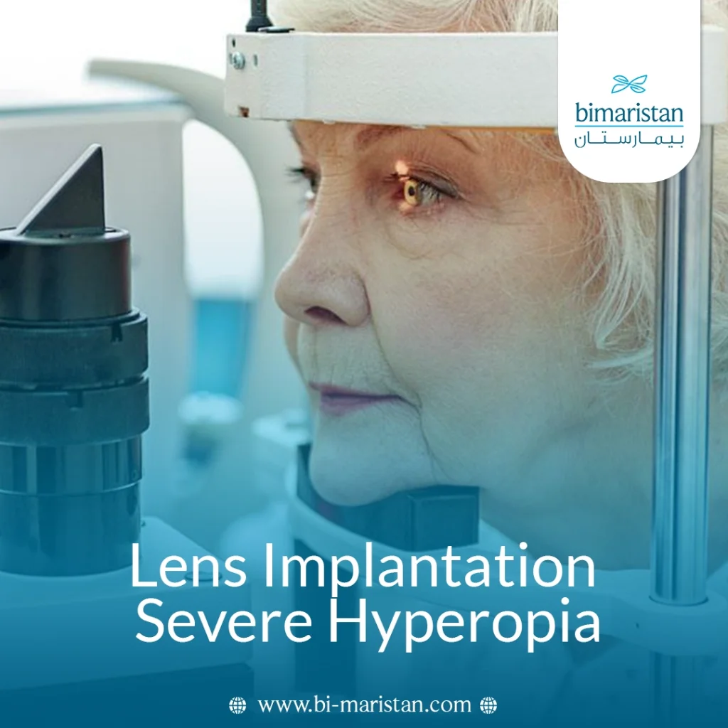 Lens Implantation Severe Hyperopia
