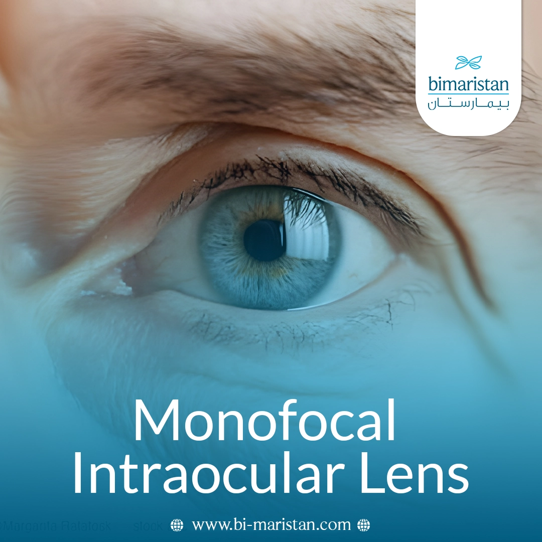 Monofocal Intraocular Lens