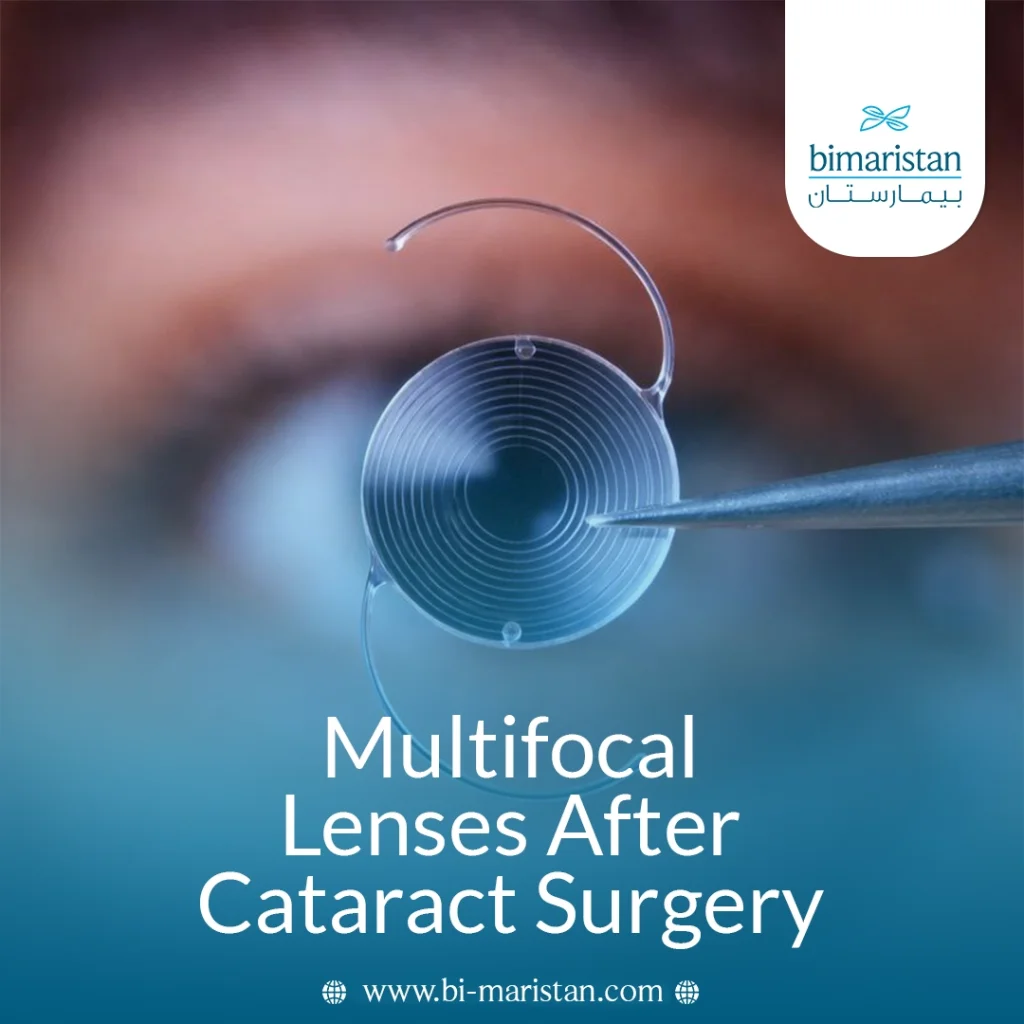 Multifocal Lenses After Cataract Surgery: Benefits, Results, And What To Expect 5 Multifocal Lenses After Cataract Surgery