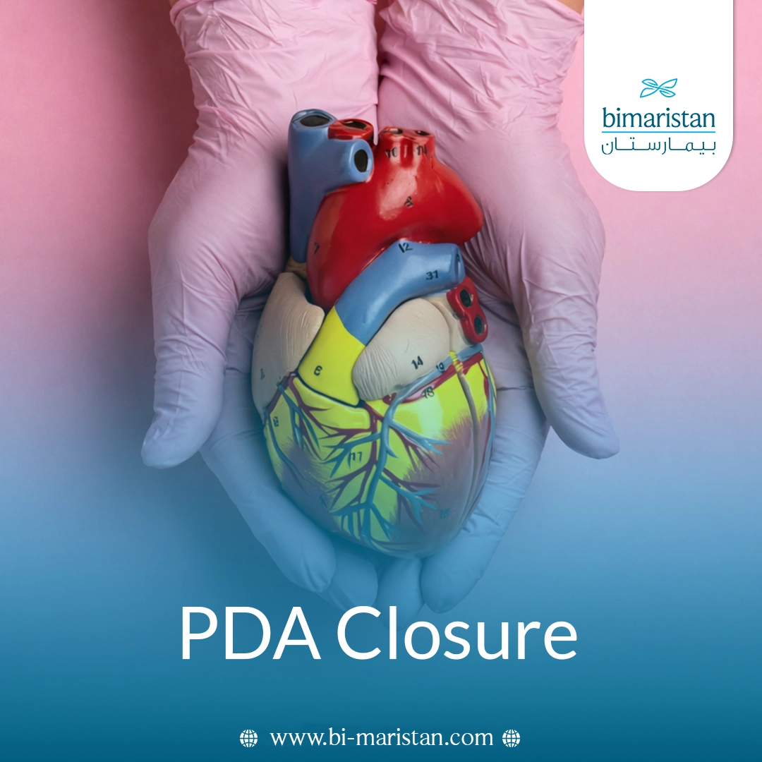 Pda Closure