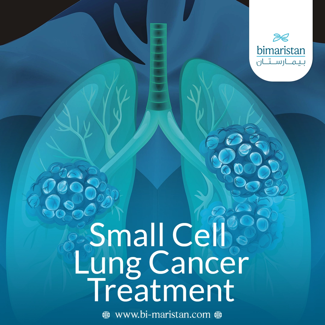 Small Cell Lung Cancer Treatment