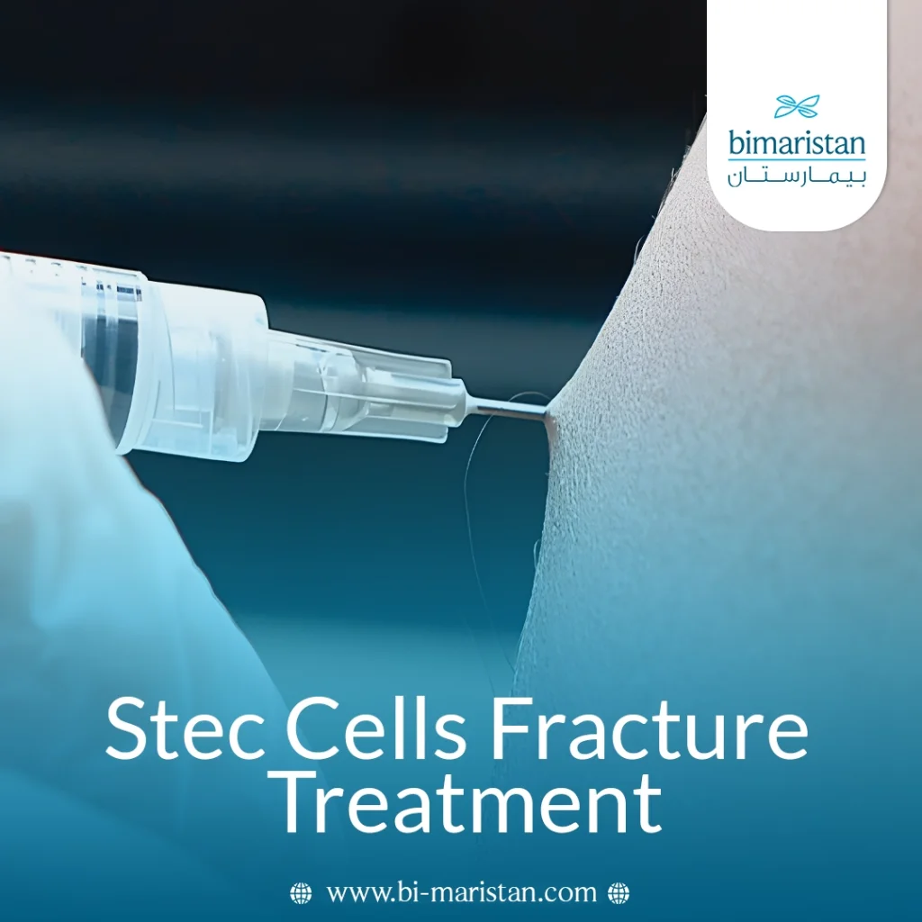 Stem Cells Chronic Fracture Treatment