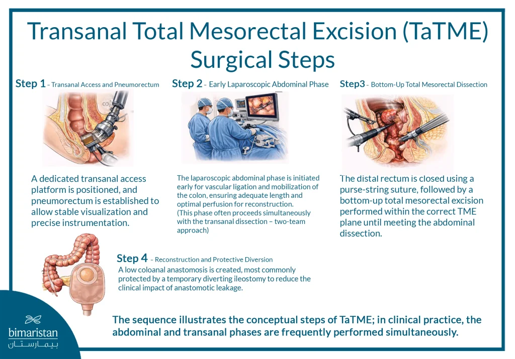 The Image Illustrates The Steps Of Tatme