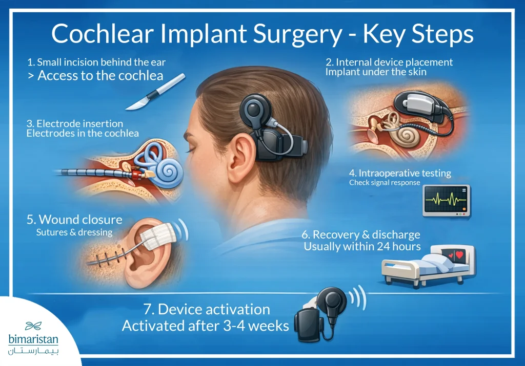 The Image Illustrates The Steps Of Cochlear Implant Surgery
