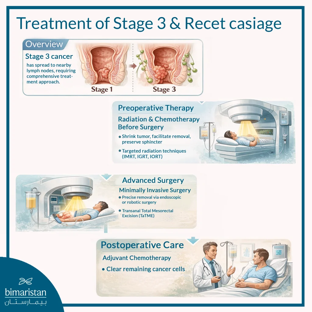 The Image Illustrates The Treatment Of Stage Iii Rectal Cancer