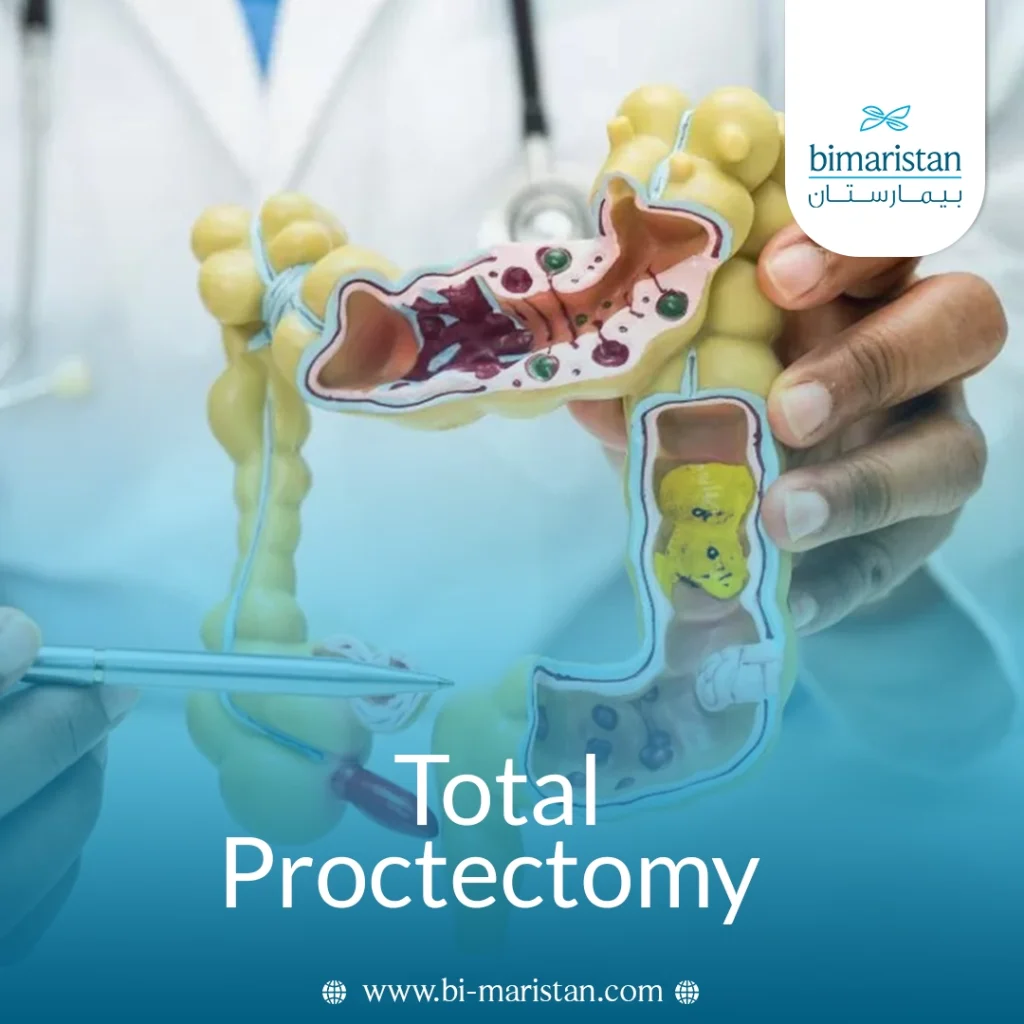 Total Proctectomy