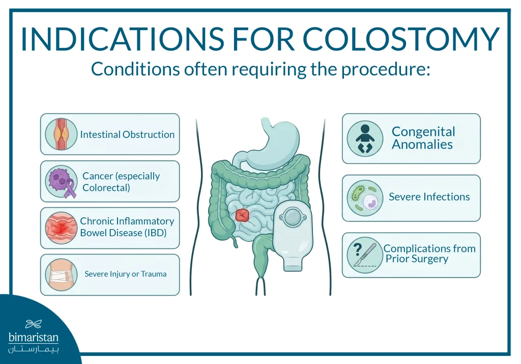 The Image Illustrates The Conditions That Require A Colostomy