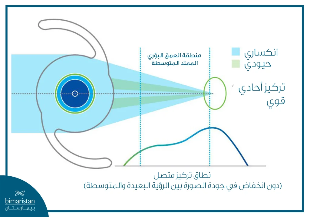رسم توضيحي يشرح آلية عمل عدسة العمق البؤري الممتد (Edof)، حيث يتم توسيع نطاق التركيز البصري لتوفير رؤية متصلة بين المسافة البعيدة والمتوسطة دون فقدان في جودة الصورة.