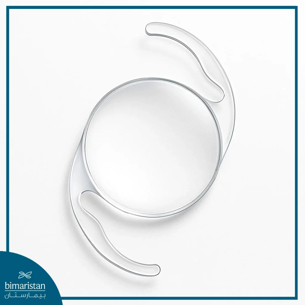 A Transparent Intraocular Lens Used In Cataract Surgery, Showing The Design Of An Extended Depth Of Focus (Edof) Iol With Flexible Haptics For Stable Positioning Inside The Eye.