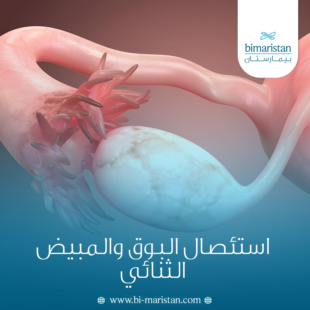 استئصال البوق والمبيض الثنائي