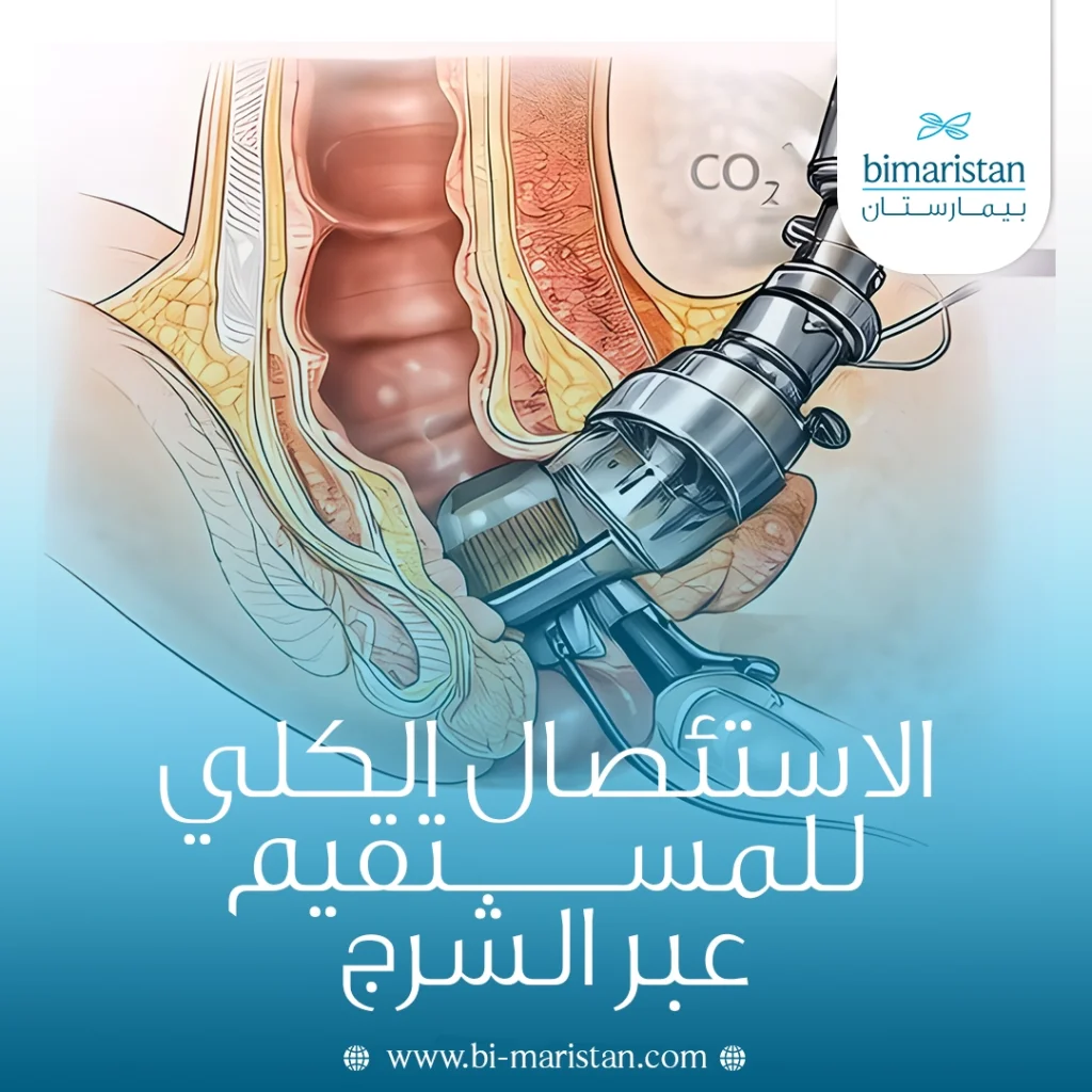 الاستئصال الكلي للمستقيم عبر الشرج