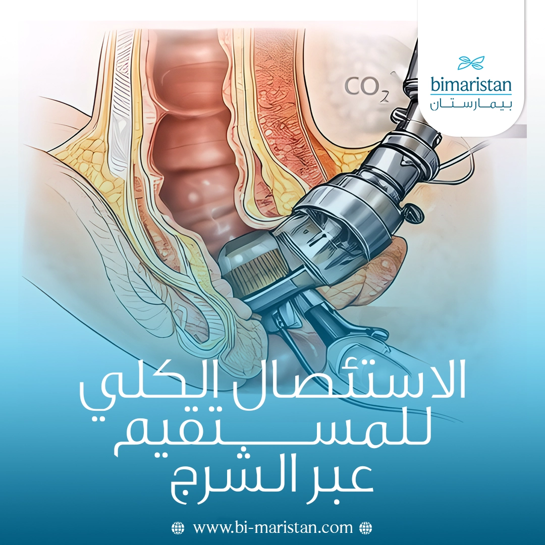 الاستئصال الكلي للمستقيم عبر الشرج