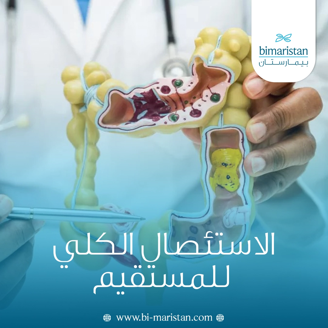 الاستئصال الكلي للمستقيم