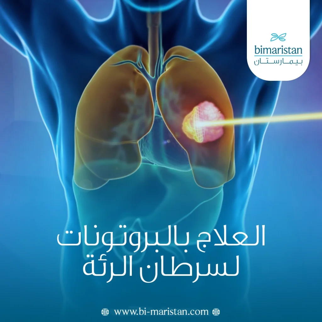 العلاج بالبروتونات لسرطان الرئة: متى يُستخدم وما الذي يميّزه؟ 6 العلاج بالبروتونات لسرطان الرئة