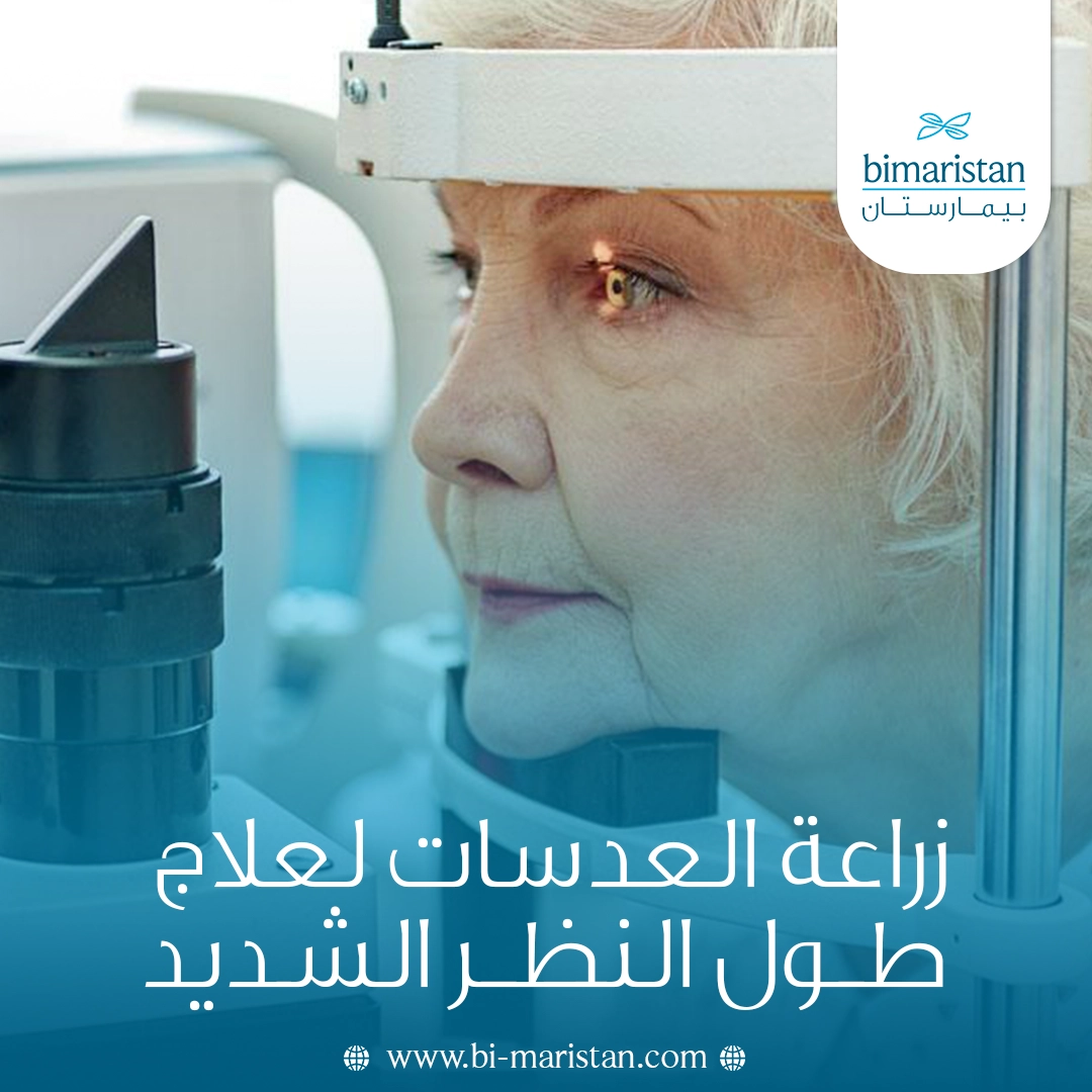 زراعة العدسات لعلاج طول النظر الشديد