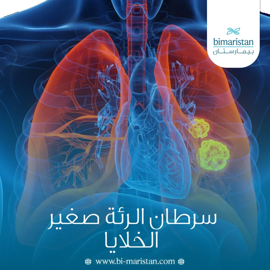 سرطان الرئة صغير الخلايا