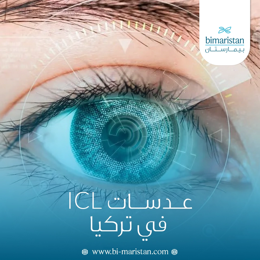 عدسات Icl في تركيا