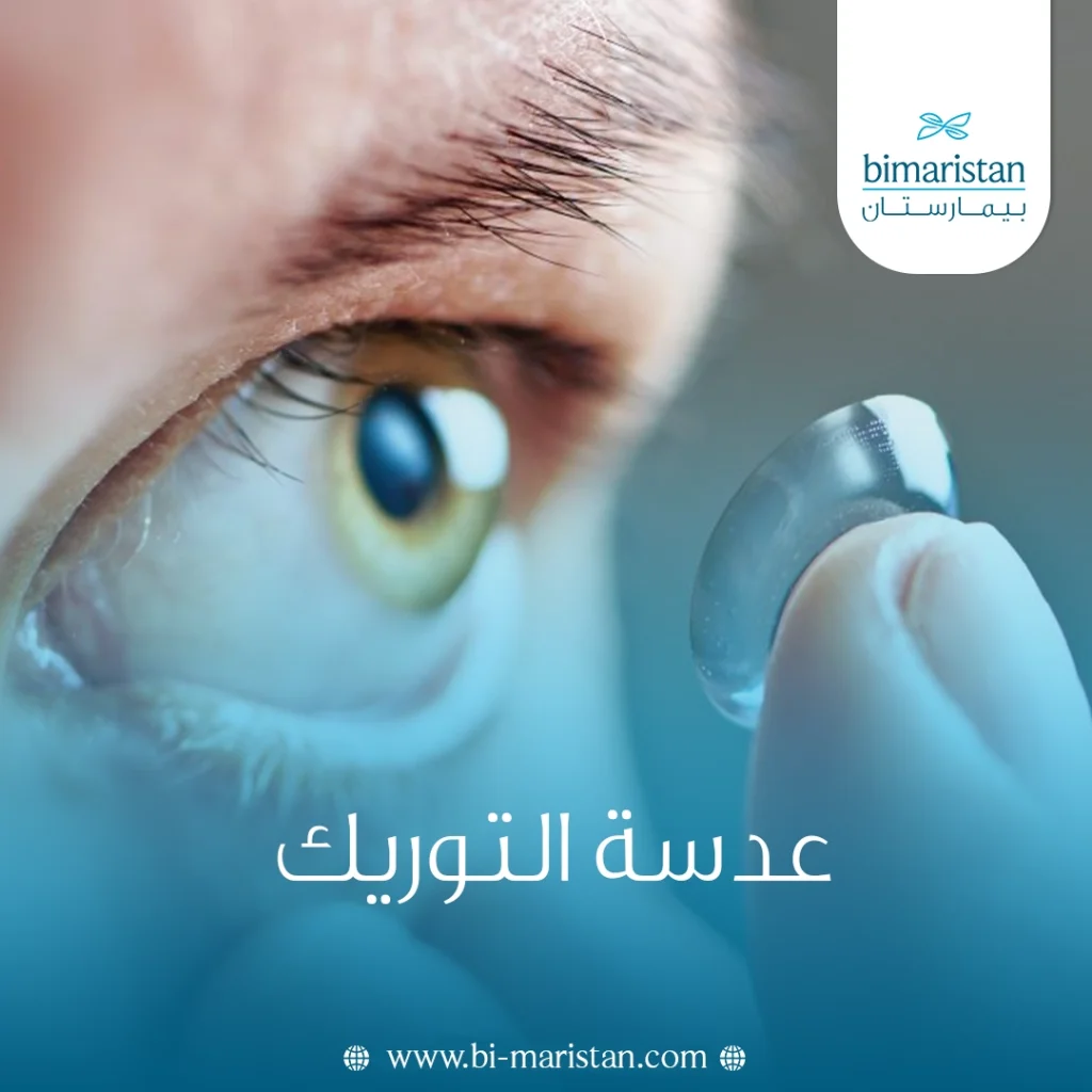 عدسة التوريك