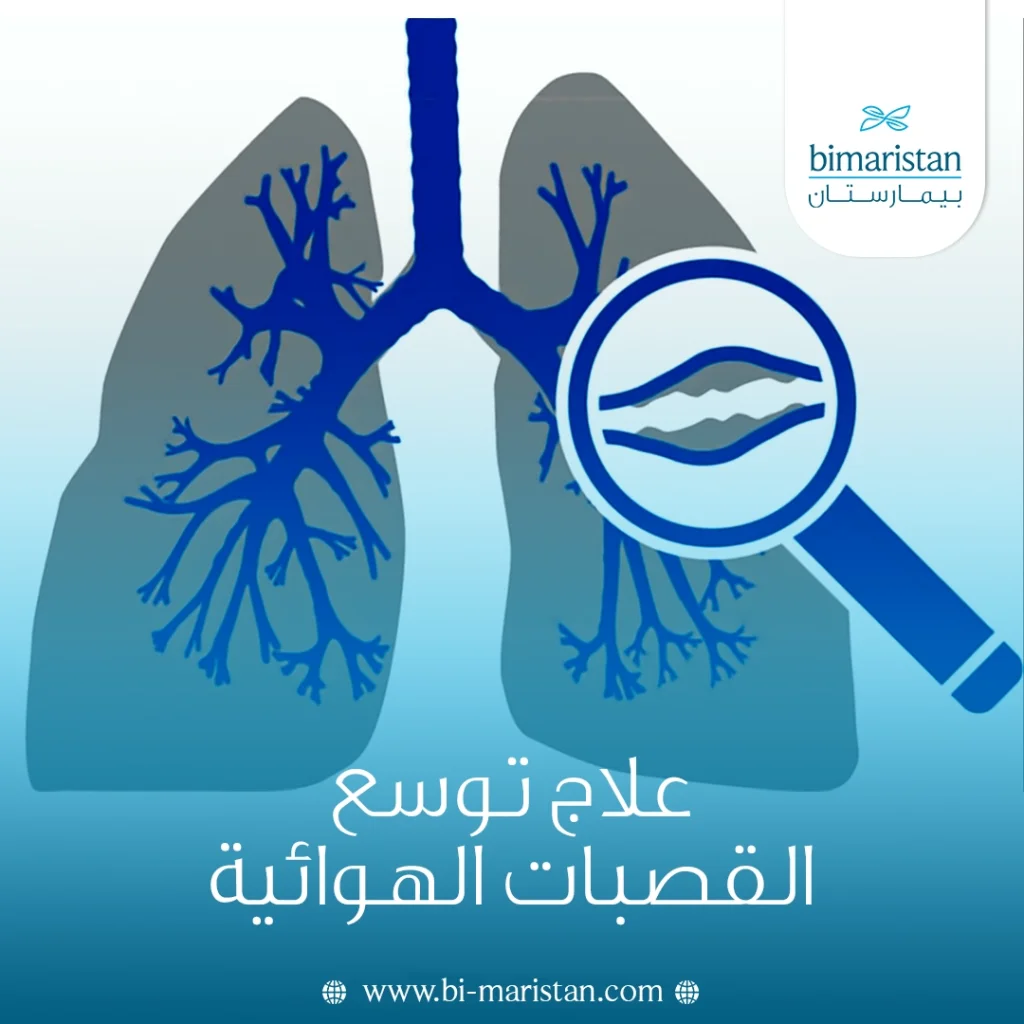 علاج توسع القصبات الهوائية