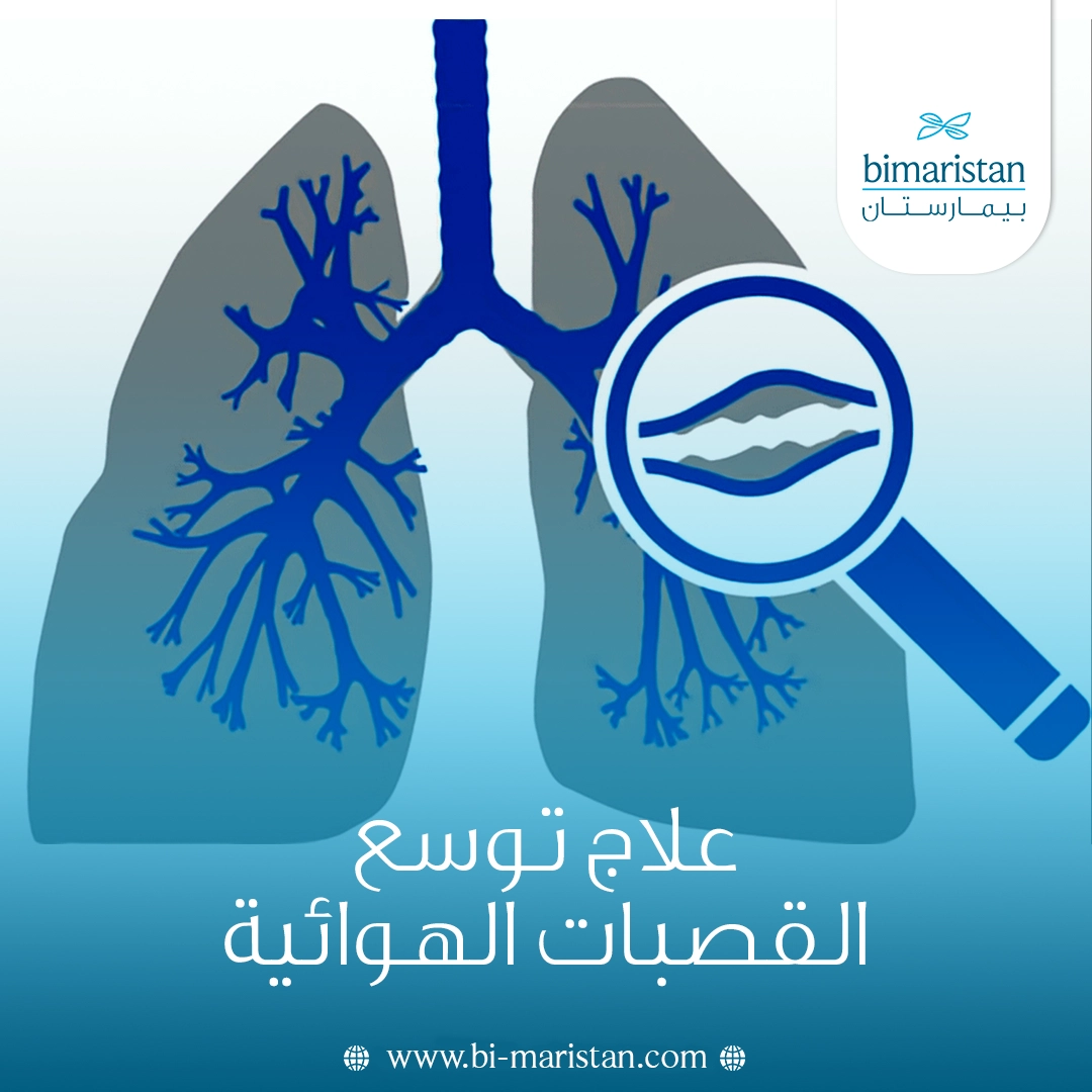 علاج توسع القصبات الهوائية