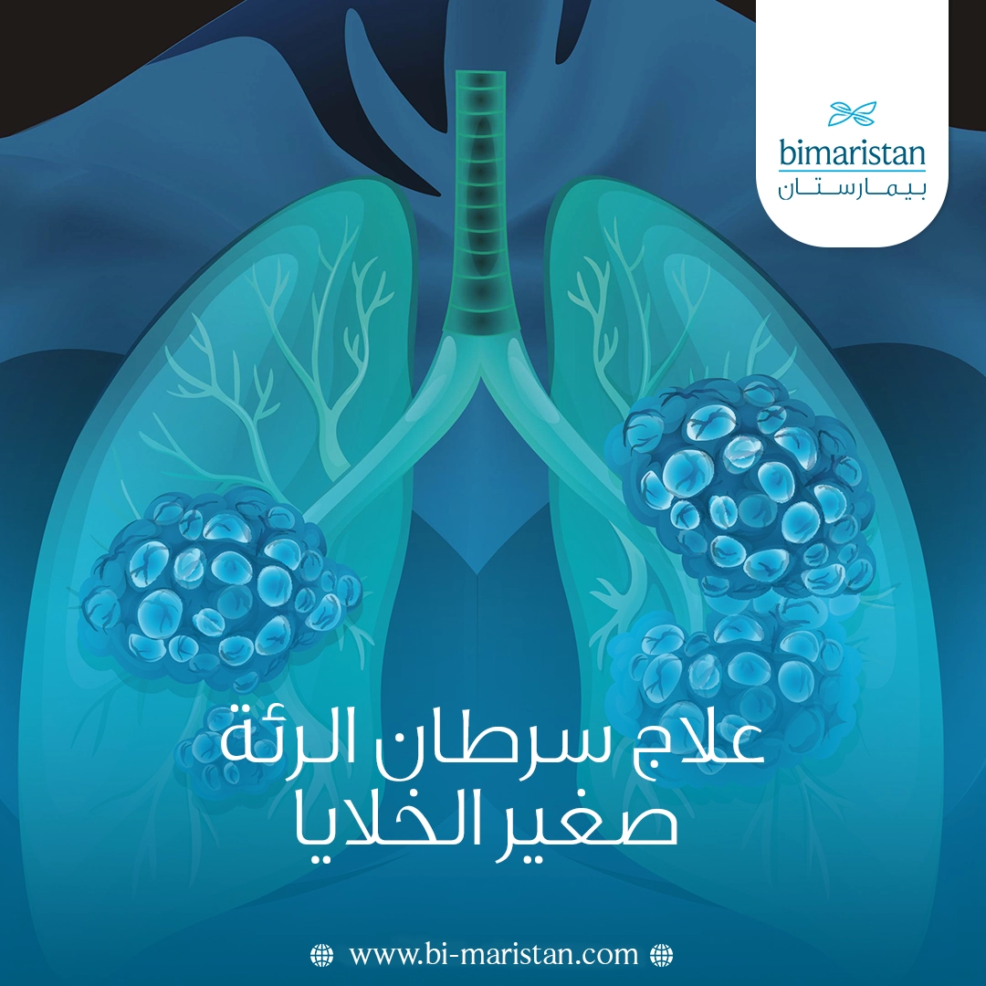 علاج سرطان الرئة صغير الخلايا